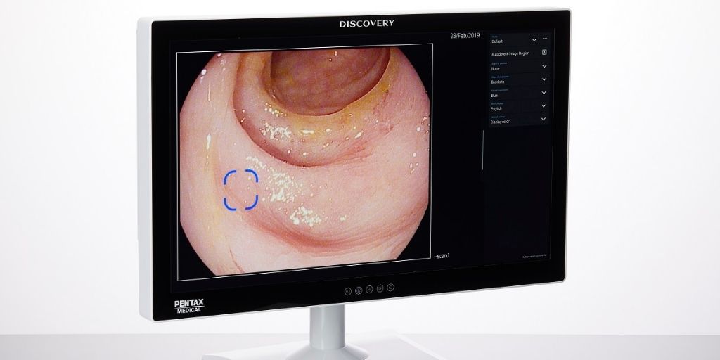 Pentax Medical A holistic approach to colonoscopy: PENTAX Medical DISCOVERY™ addresses the human factor